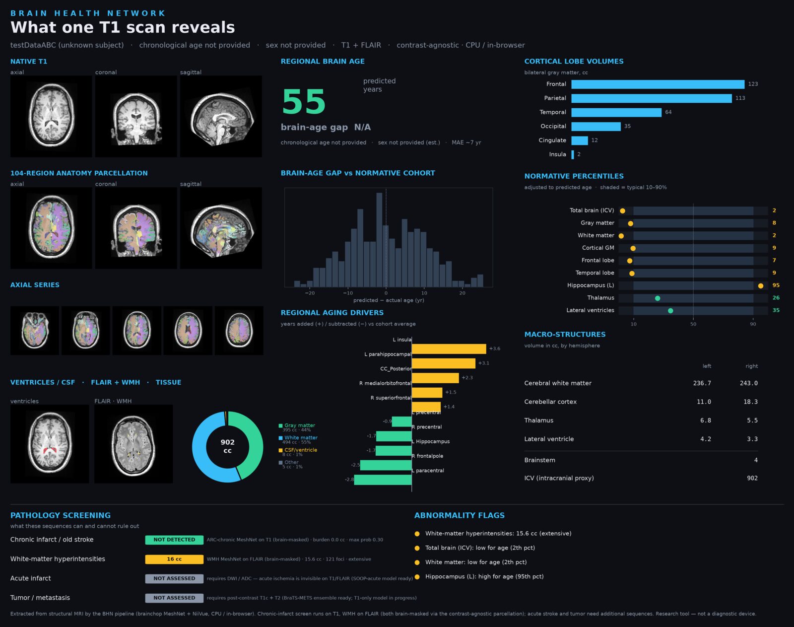 A single-page Brain Health Network readout from one T1 scan. The dashboard shows a native-T1 ortho triplet, 104-region parcellation, regional brain age at 55 years, a brain-age gap distribution against a normative cohort, cortical lobe volumes bar chart, normative percentiles, regional aging drivers, tissue pie chart, and pathology screening flags for chronic infarct, white-matter hyperintensities, acute infarct, and tumor.